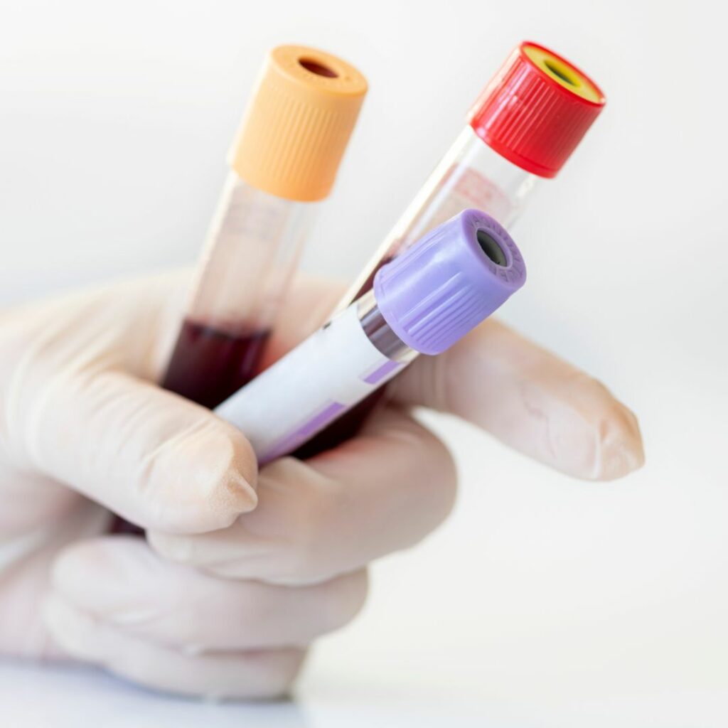 Blood Samples - Donahue Law Firm
